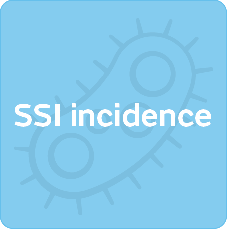 SSIs