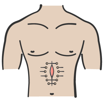 Dehisced wound icon